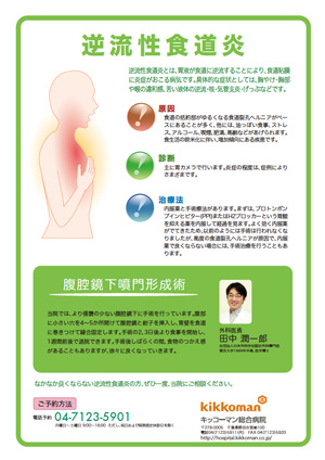 逆流性食道炎