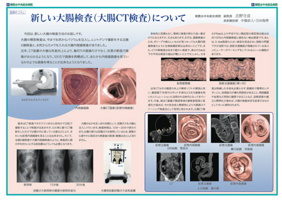 大腸CT検査