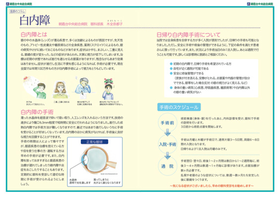 白内障