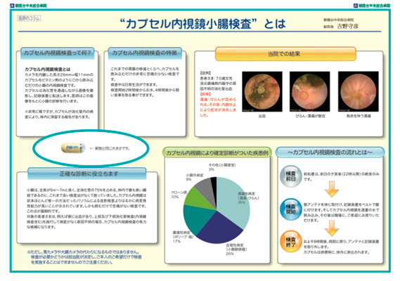 カプセル内視鏡小腸検査